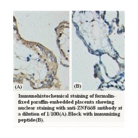 ZNF668 Antibody