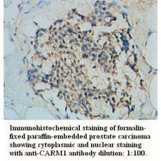 CARM1 Antibody
