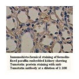 Tumstatin Antibody
