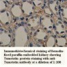 Tumstatin Antibody