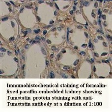 Tumstatin Antibody