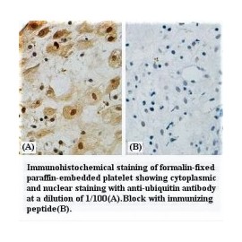 UBB Antibody
