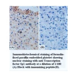 SP1 Antibody