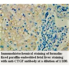 CTGF Antibody