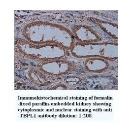 TBPL1 Antibody