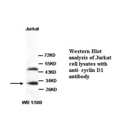 Cyclin D1 Antibody