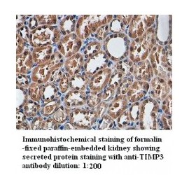 TIMP3 Antibody
