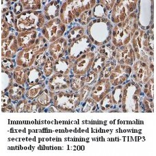 TIMP3 Antibody