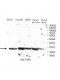 TIMP3 Antibody
