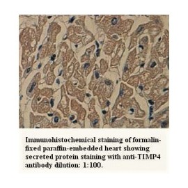TIMP4 Antibody