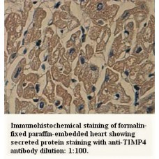 TIMP4 Antibody