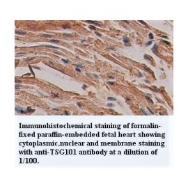 TSG101 Antibody