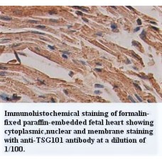 TSG101 Antibody