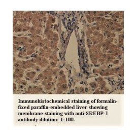 SREBP-1 Antibody