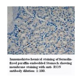 RON Antibody