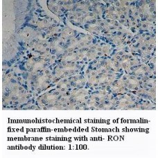 RON Antibody