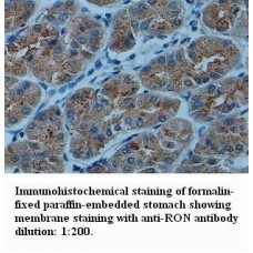 RON Antibody