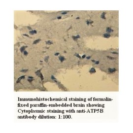 ATP5B Antibody