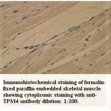 TPM4 Antibody
