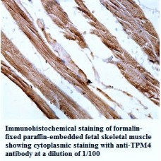 TPM4 Antibody
