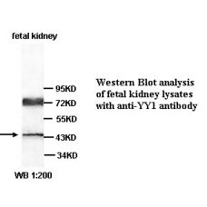 YY1 Antibody