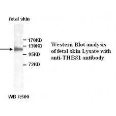 YY1 Antibody