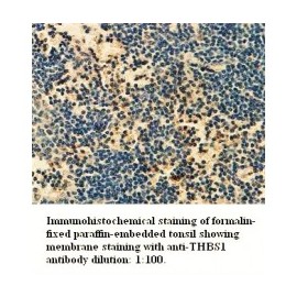 THBS1 Antibody