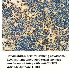 THBS1 Antibody