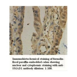 SMAD1 Antibody