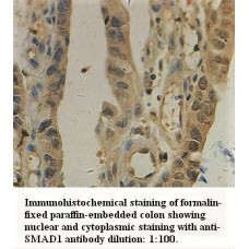 SMAD1 Antibody