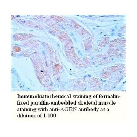 Cytochrome B Antibody