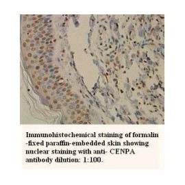 CENPA Antibody