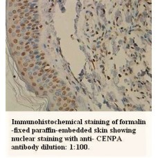 CENPA Antibody