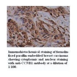CCNB1 Antibody