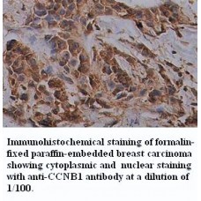 CCNB1 Antibody