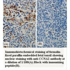 CCNA2 Antibody
