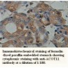 ACOT11 Antibody