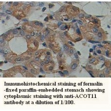 ACOT11 Antibody