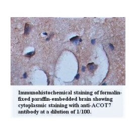ACOT7 Antibody
