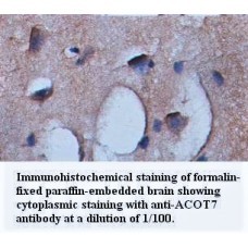 ACOT7 Antibody
