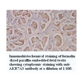 AKR7A3 Antibody