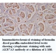 AKR7A3 Antibody