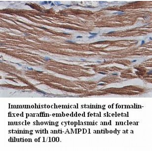  AMPD1 Antibody
