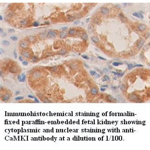 CaMKI Antibody