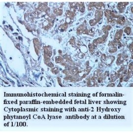 2-hydroxyacyl-CoA Lyase 1 Antibody