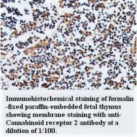 Cannabinoid Receptor 2 Antibody