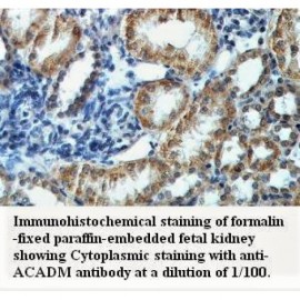 ACADM Antibody