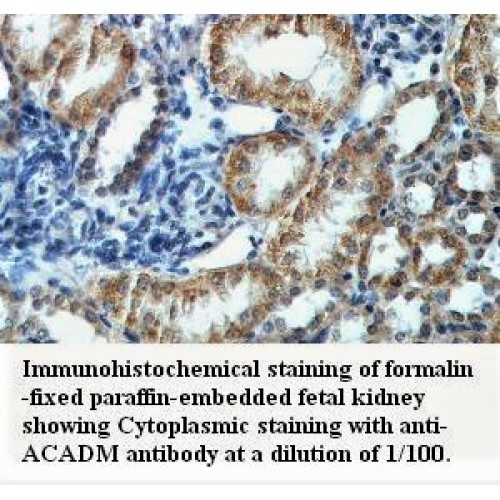 ACADM Antibody