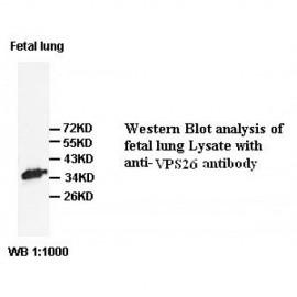 VPS26 Antibody