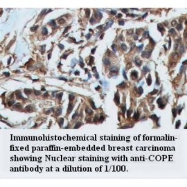 COPE Antibody